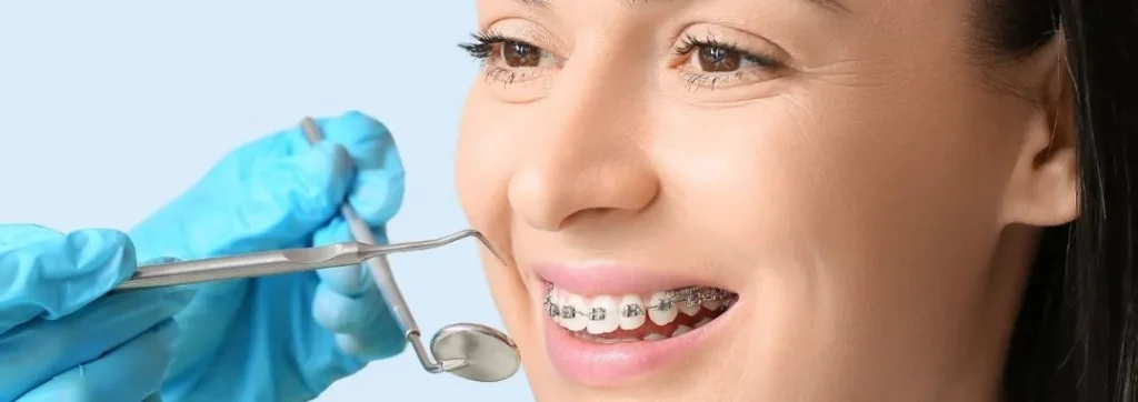 Cómo alinear tus dientes