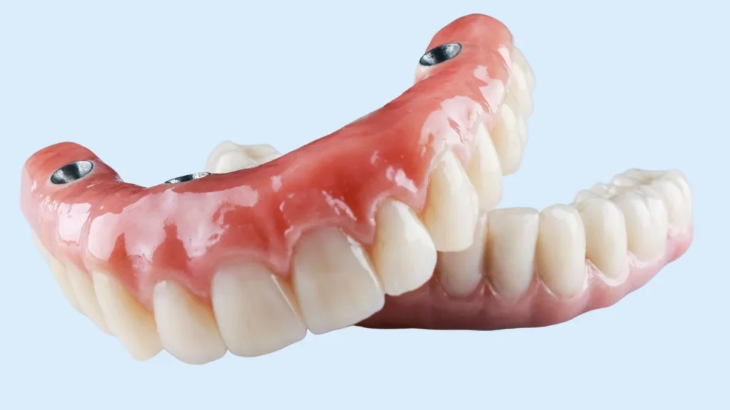 Tipos de prótesis dentales: Guía completa para pacientes