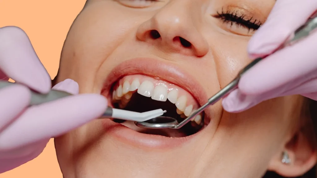 destartraje supragingival