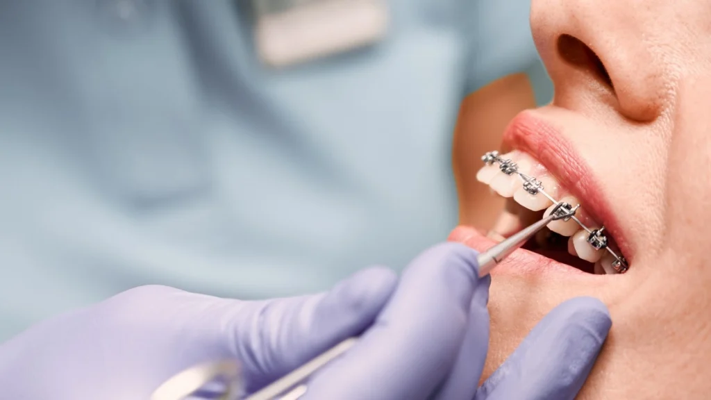 ¿Cómo saber si mi ortodoncista es realmente especialista en ortodoncista? Guía para elegir correctamente