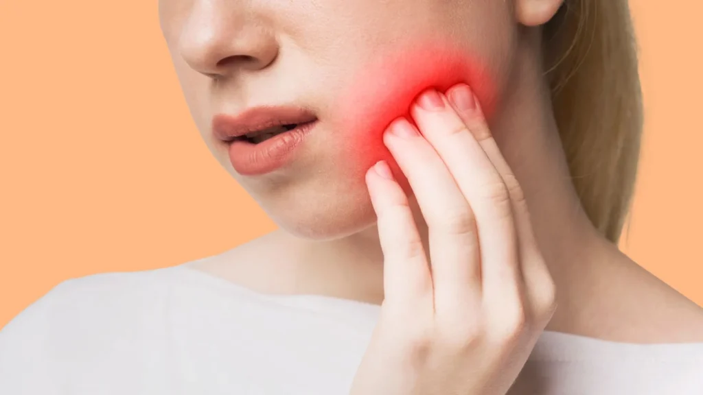 Pericoronaritis: qué es y cómo tratar esta infección de la muela del juicio